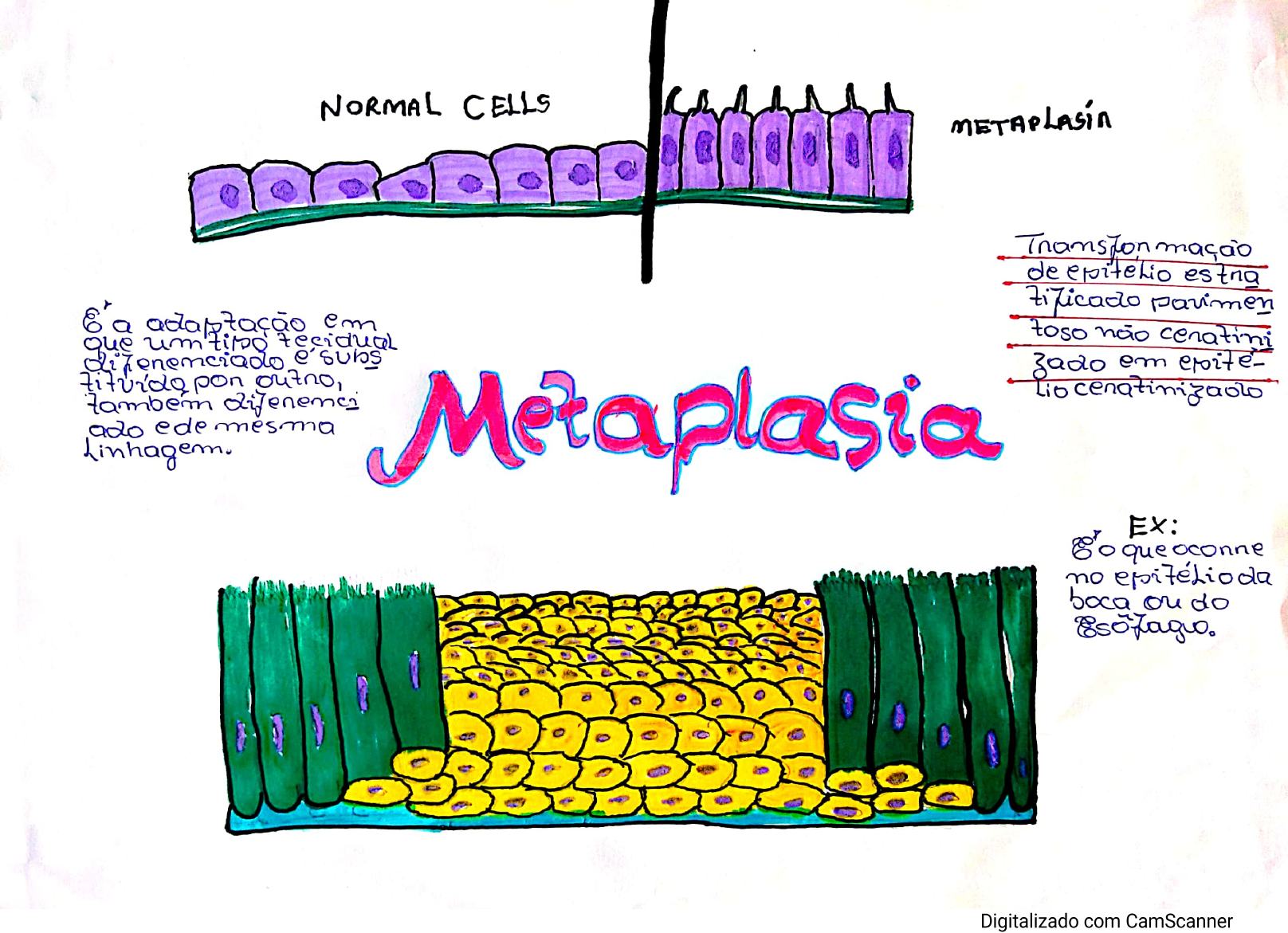 Metaplasia Patologia Em Enfermagem