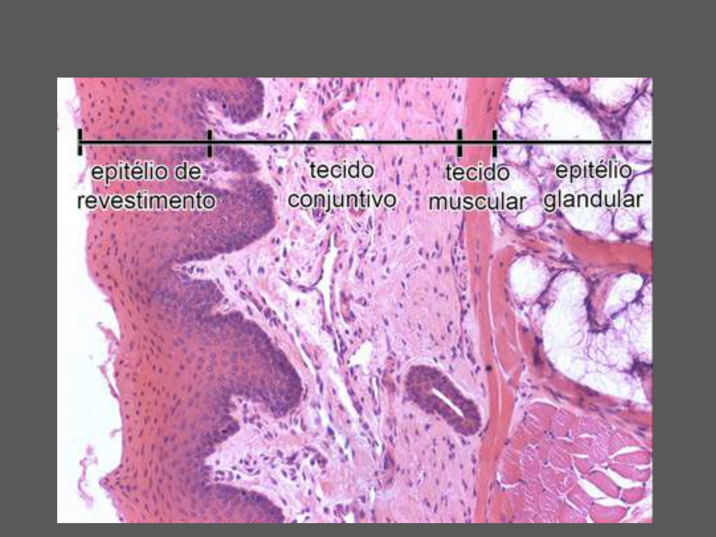 Histologia Humana Tecido Epitelial Tecido Conjuntivo Vrogue Co