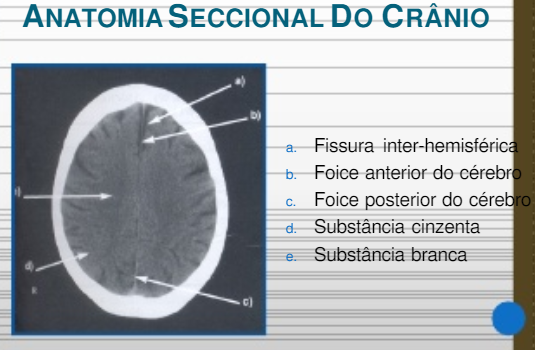 ANATOMIA SECCIONAL DO CRÂNIO 3 Anatomia I