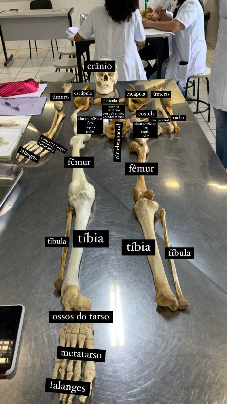 Resumo Esqueletos Axial e Apendicular Anatomia Sistêmica