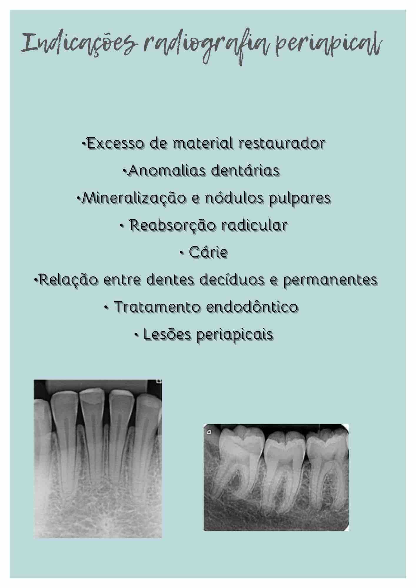 Indica Es Radiografia Periapical Radiologia Odontol Gica