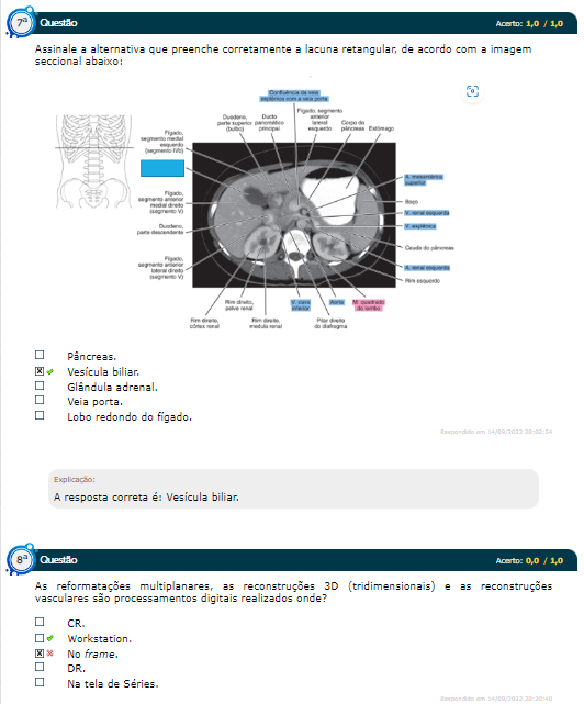 SIMULADO ANATOMIA RADIOLOGICA TOPOGRAFICA E SECCIONAL 1 4 Anatomia