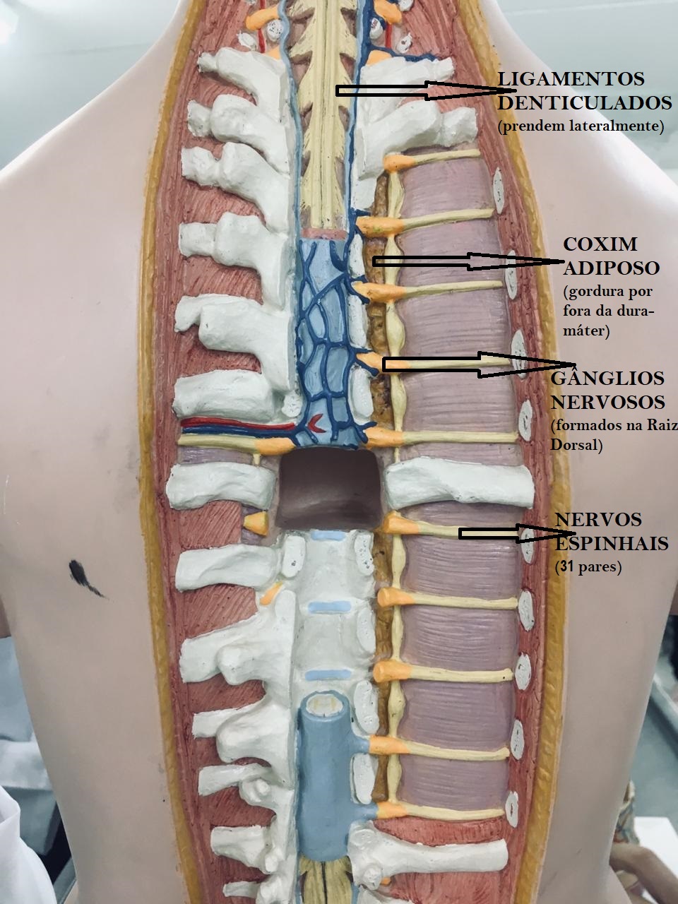 Nervos Espinhais Ganglios Coxim Neuroanatomia