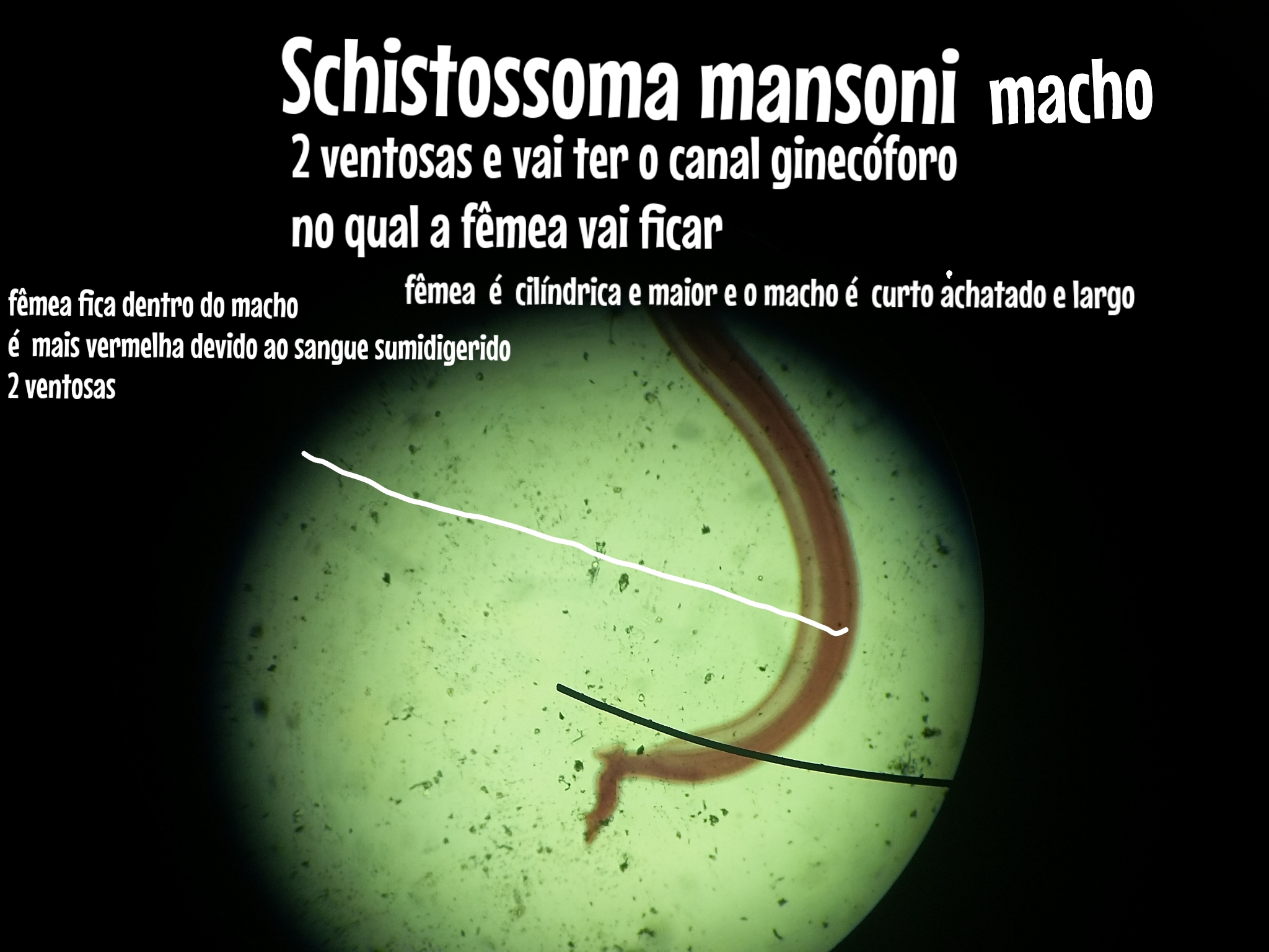 schistosoma mansoni macho e fêmea Morfo IV