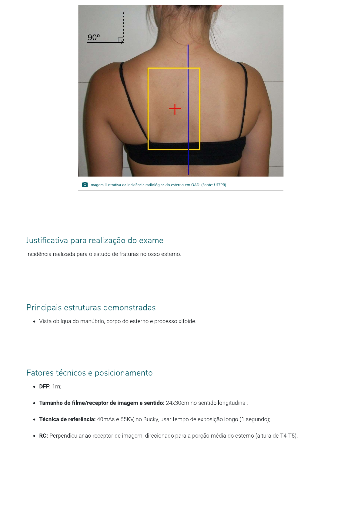 Aula Incid Ncias Radiol Gicas Da Caixa Tor Cica Incid Ncias