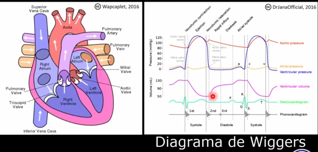 Wiggers Diagramm