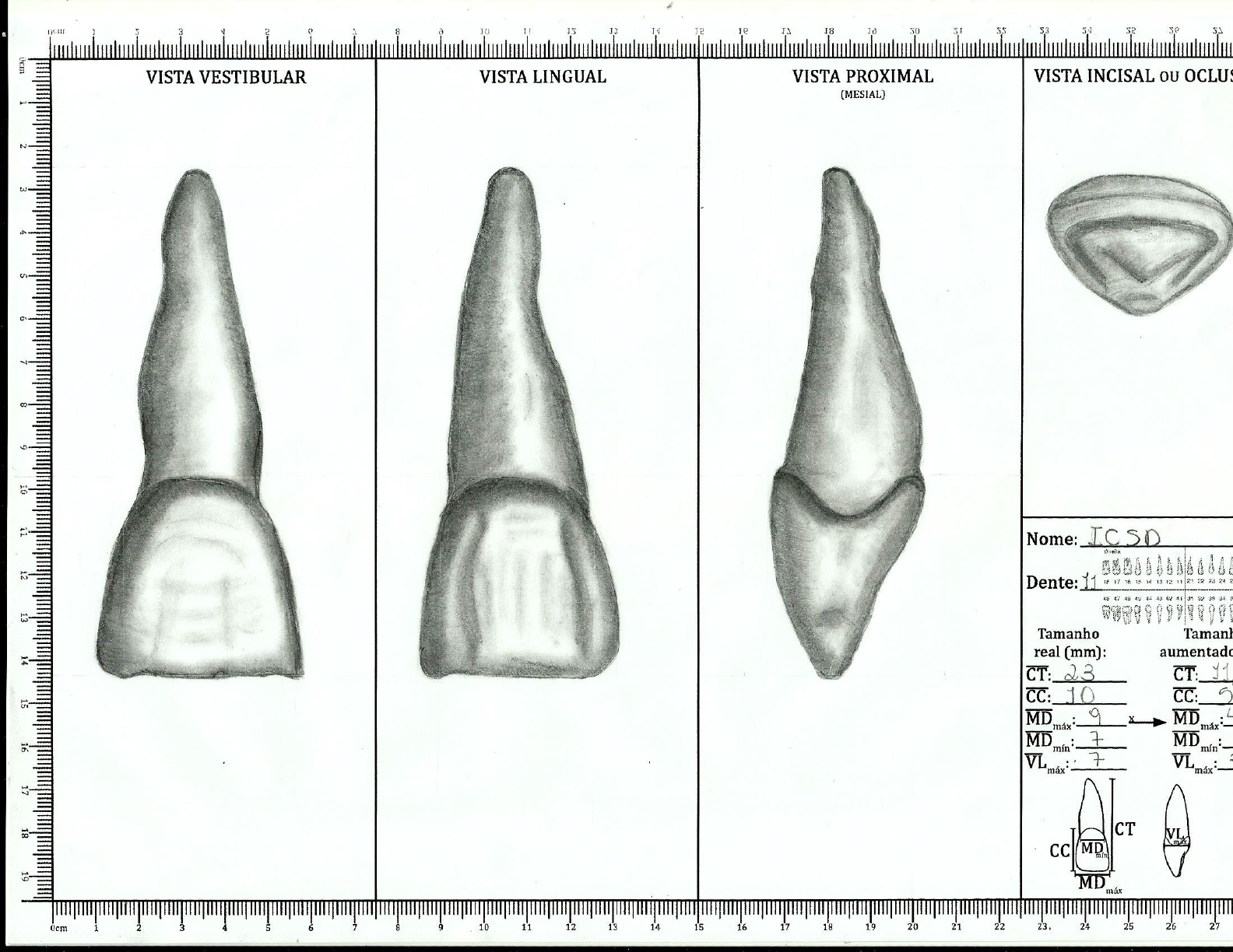 Icsd Desenho Anatomia E Escultura