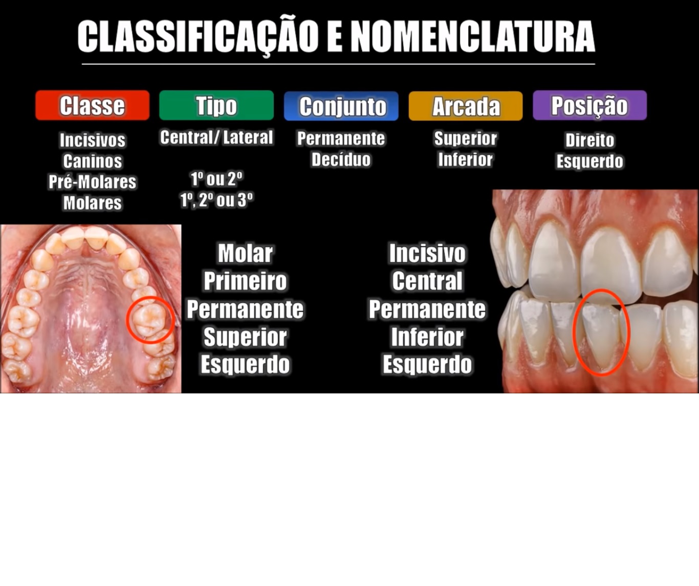 Aprendendo A Conhecer Os Caprinos E Ovinos Parte Ii Denti O