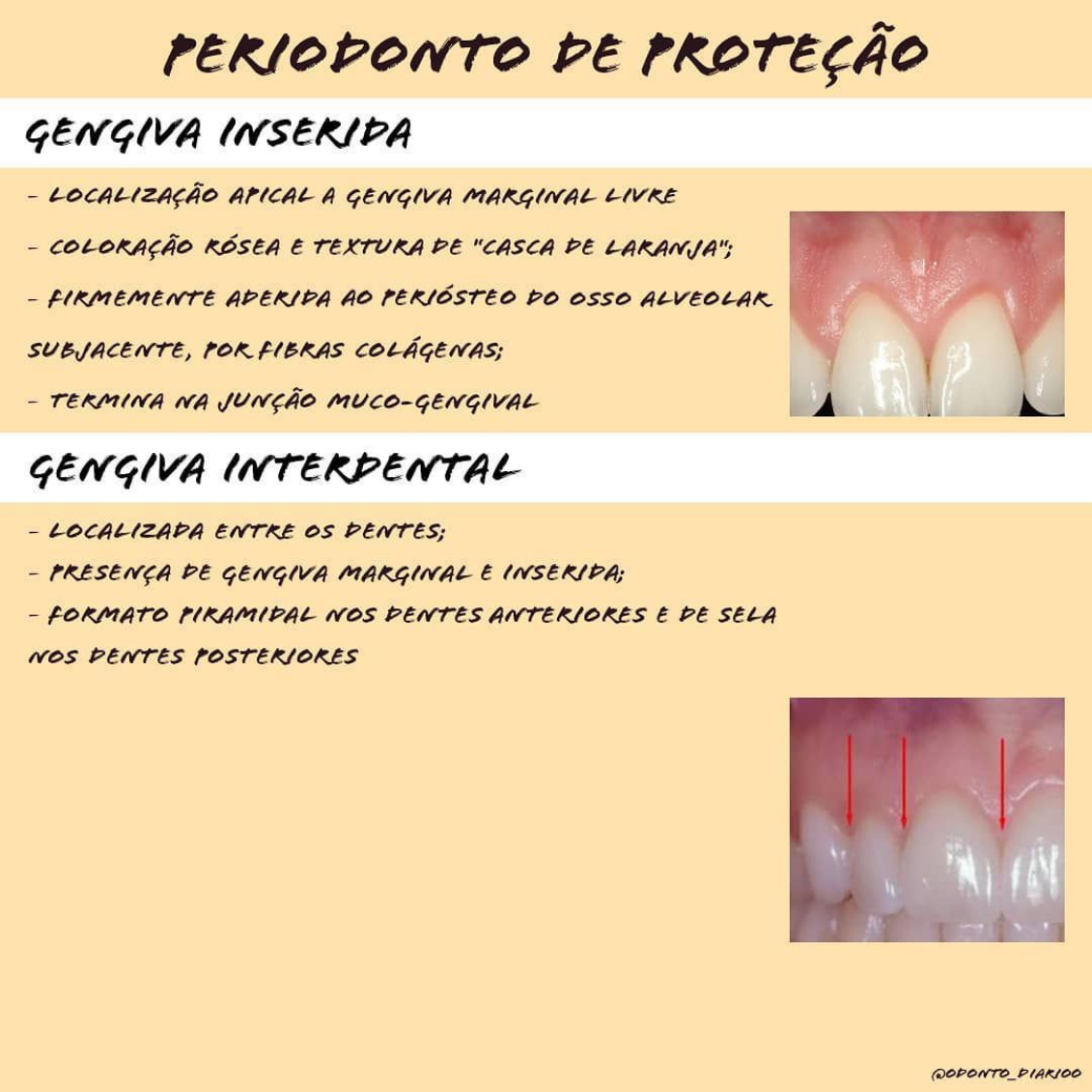 Periodonto De Prote O Periodontia