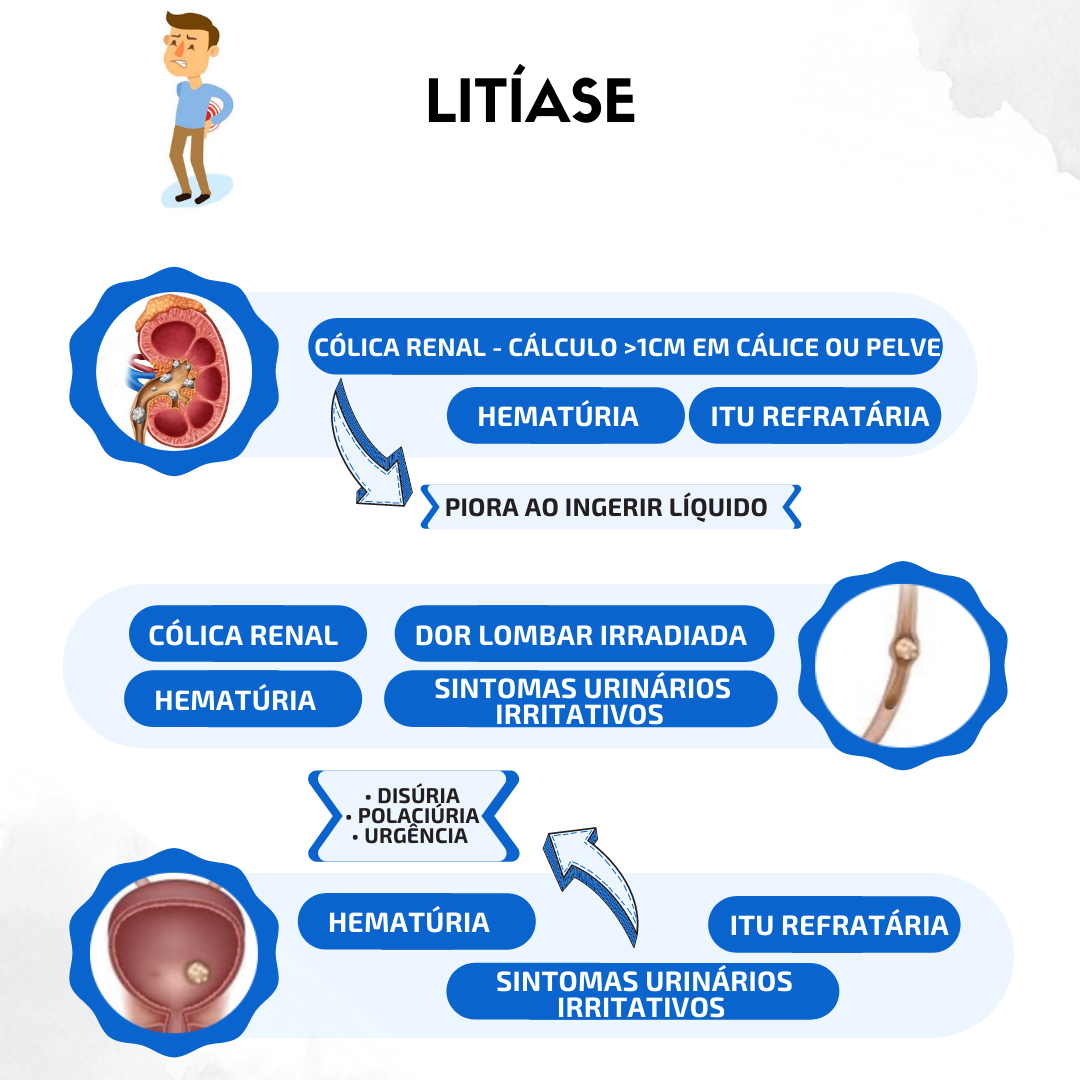 Litíase renal Urologia