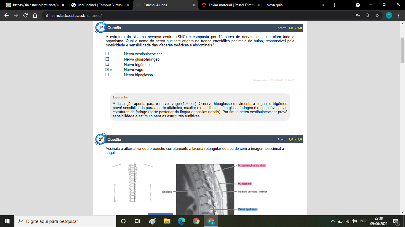 Simulado Av Anatomia Radiol Gica Topogr Fica E Seccional Anatomia