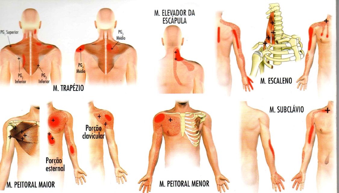 Guia Pratico Dor Miofascial E Ponto Gatilhos Sem Separacao Fisioterapia