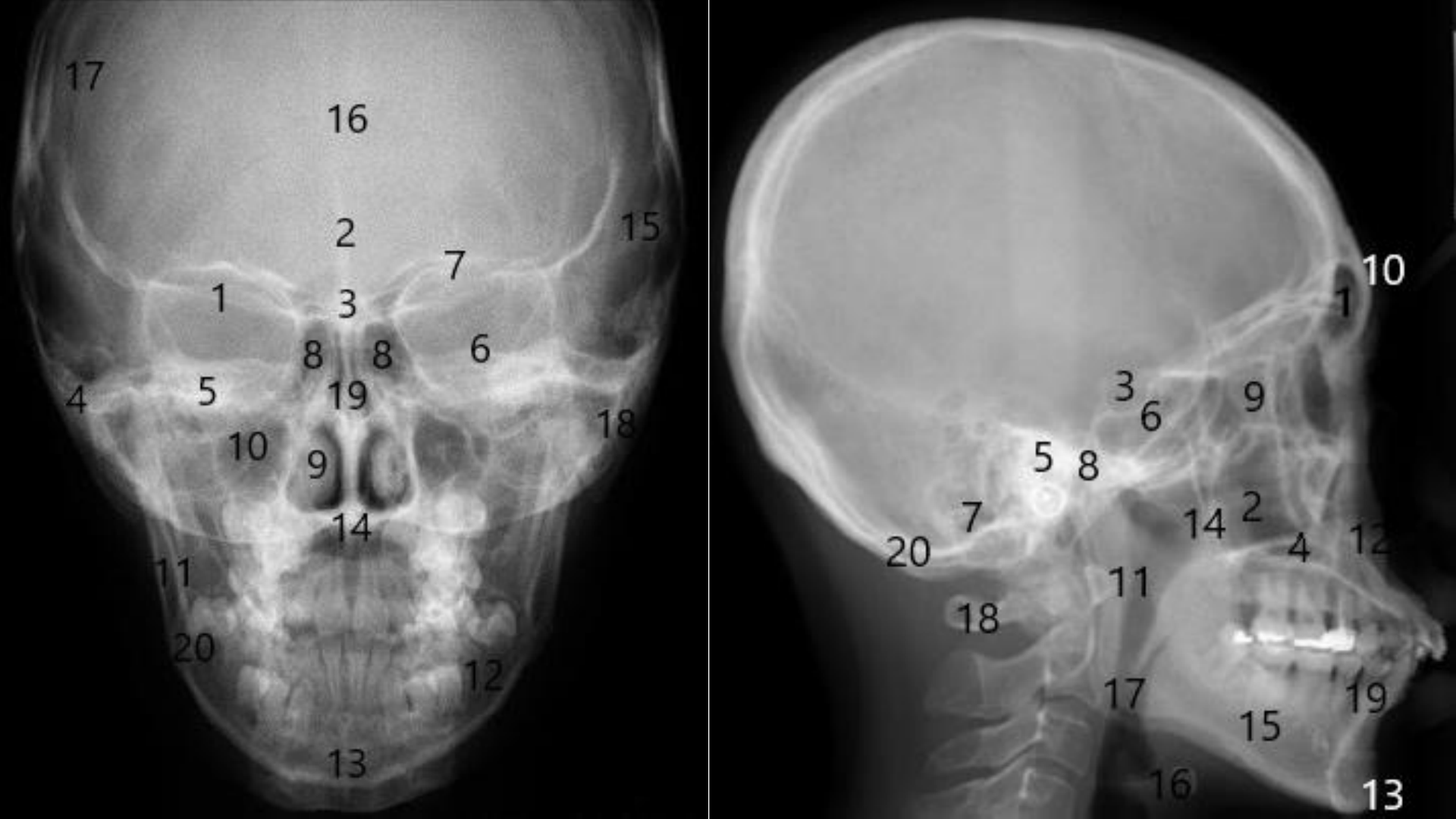 Atividade sobre estruturas da face nos rx Anatomia Radiológica