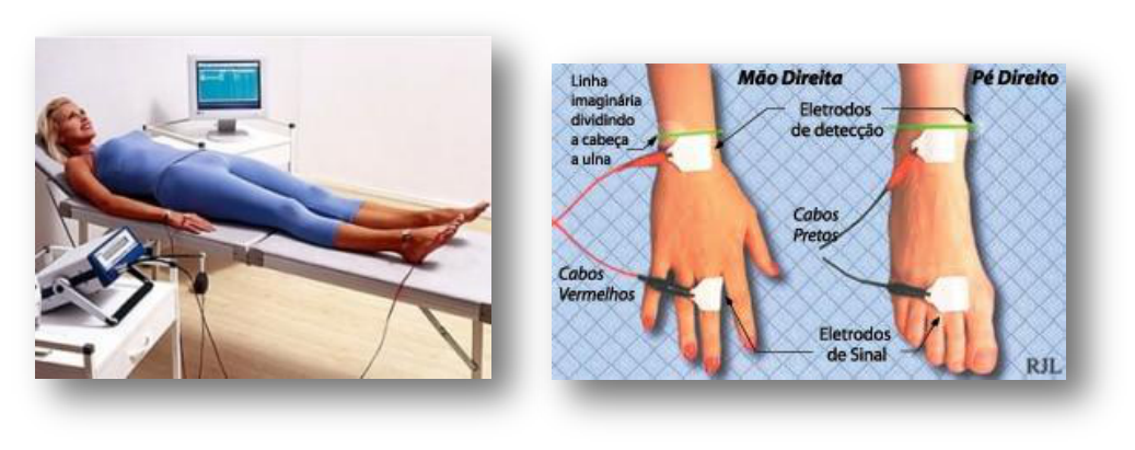 Bioimped Ncia Ou Antropometria Qual O Melhor Avalia O Off