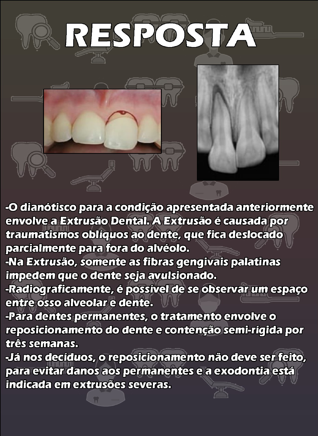 Traumatismo Dento Alveolar Caso Cl Nico Dental Charts Odontologia