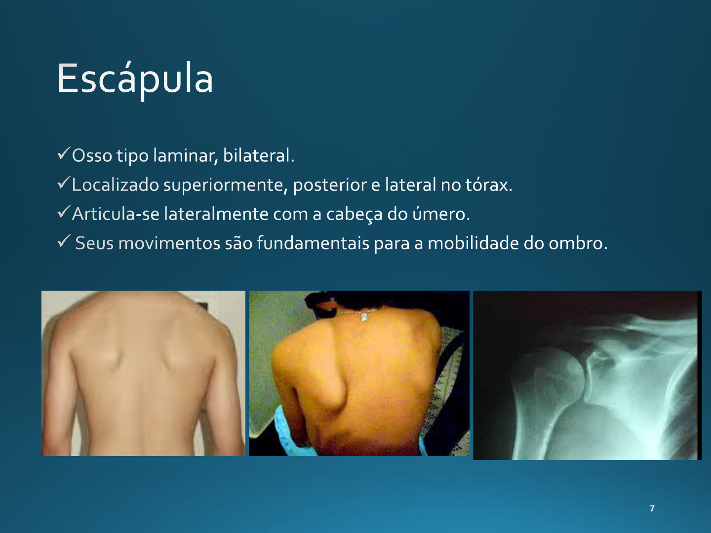 Osteologia Cintura Escapular E Membro Superior Aparelho