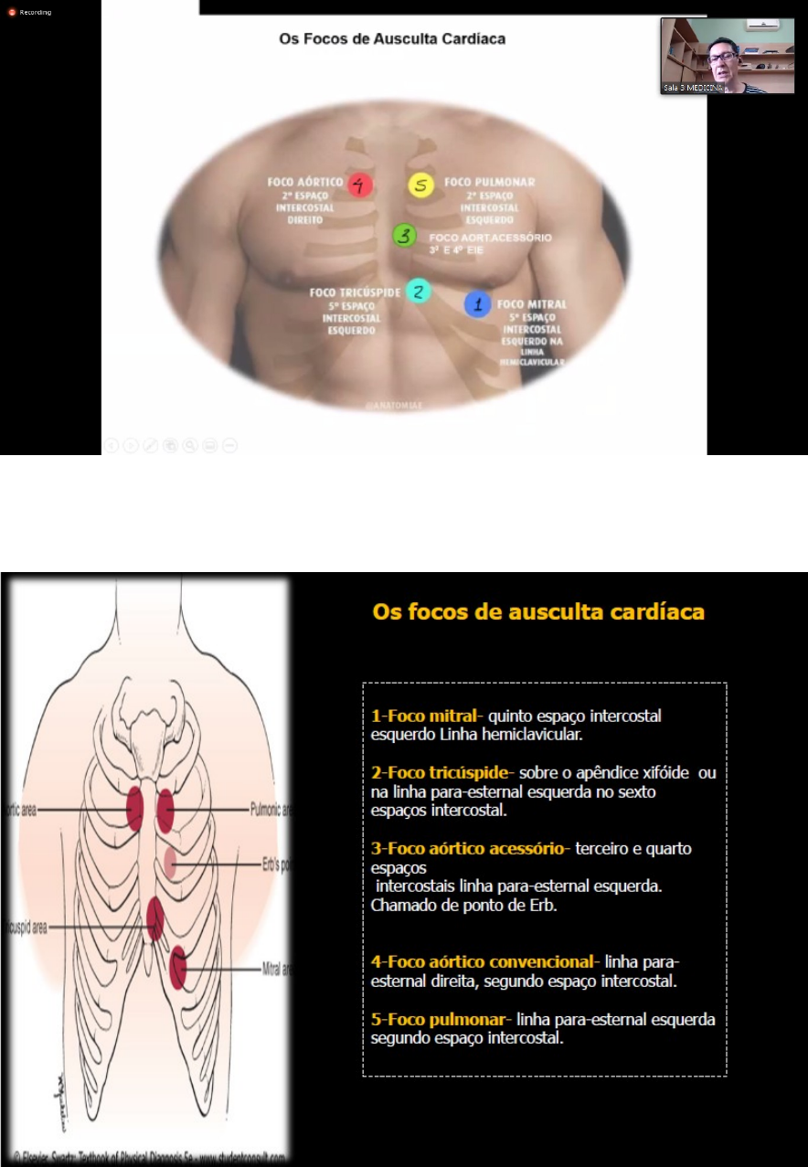 O Ciclo Cardíaco E A Ausculta Cardíaca Mila Semiologia 55 OFF