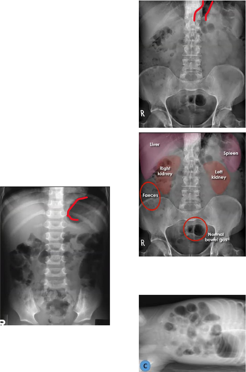 Radiologia: Abdômen simples