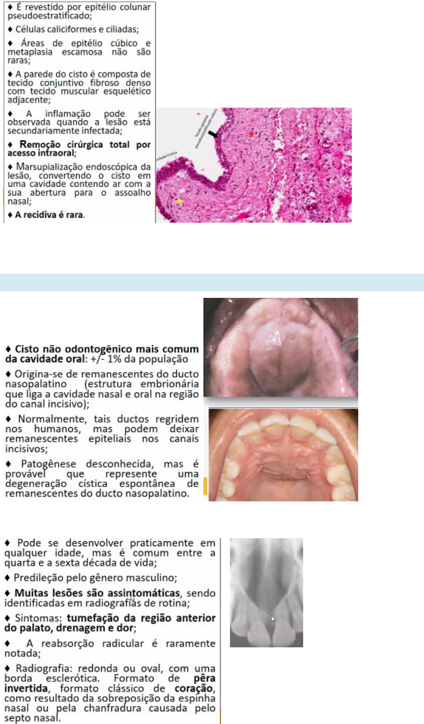 Grátis: CISTOS DO DESENVOLVIMENTO - Material Claro e Objetivo em PDF para  Estudo Rápido, image size:863x1473