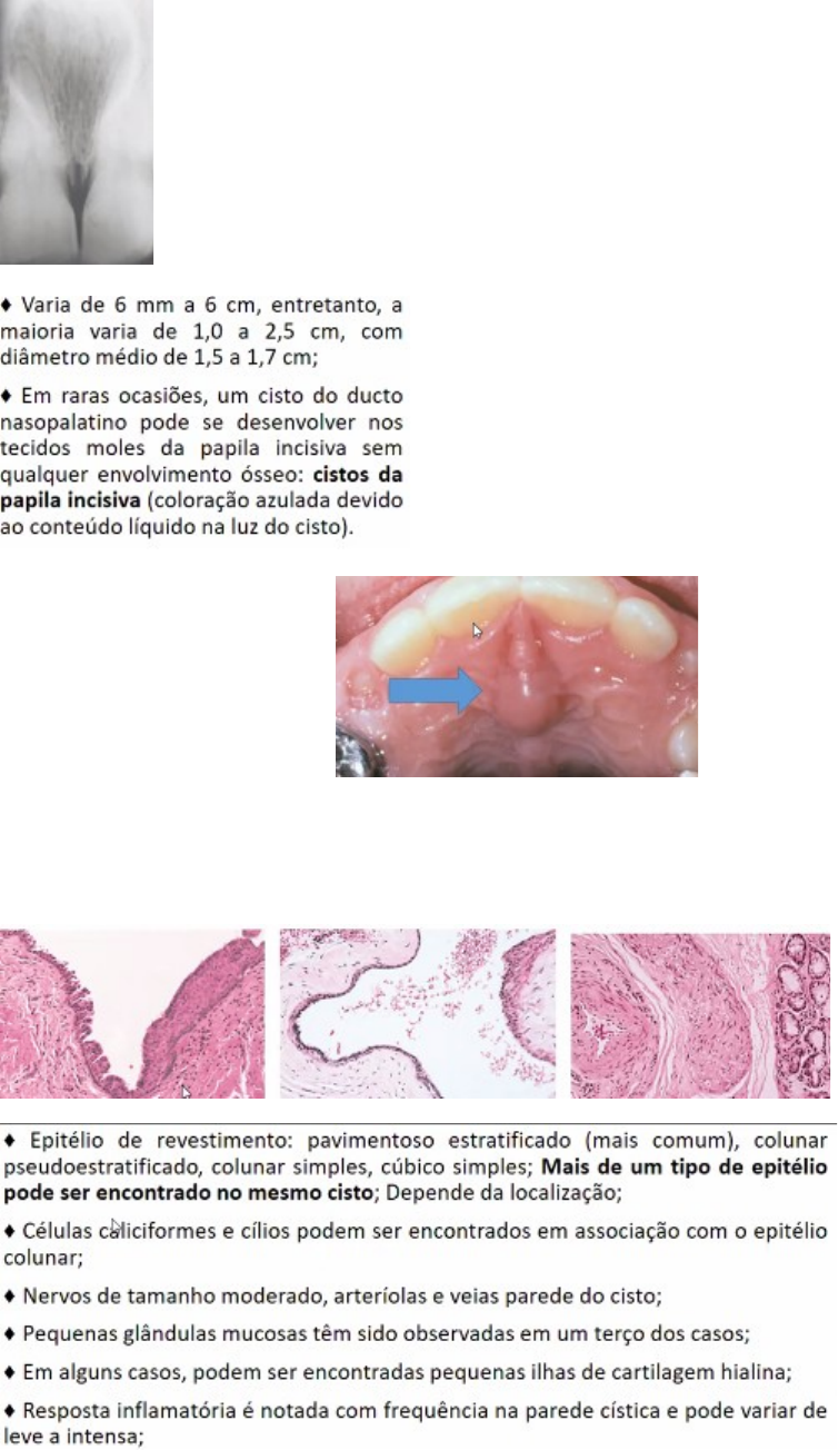 Hoje falaremos sobre: Cisto do Ducto Tireoglosso. É a anomalia congênita  mais comum que ocorre na região mediana do pescoço. E ocorre devido a uma  falha na obliteração do ducto embrionário gerada, image size:754x1304
