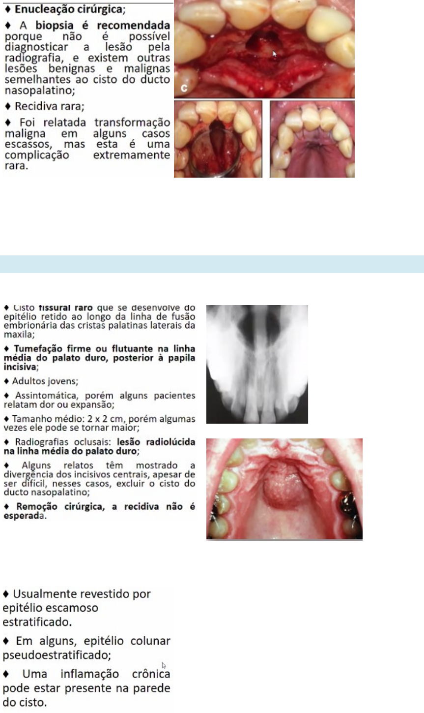 Grátis: CISTOS DO DESENVOLVIMENTO - Material Claro e Objetivo em PDF para  Estudo Rápido, image size:863x1449