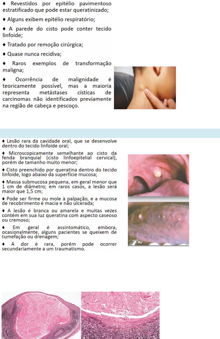 Grátis: CISTOS DO DESENVOLVIMENTO - Material Claro e Objetivo em PDF para  Estudo Rápido, image size:863x1331