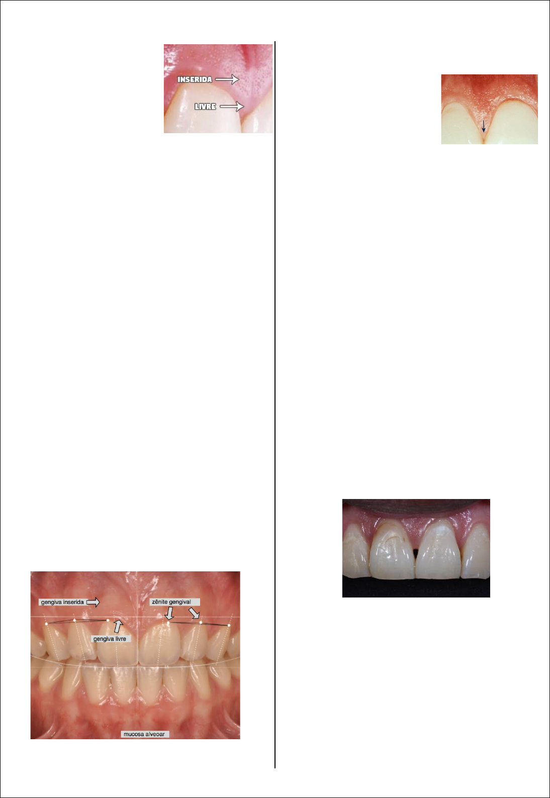 Feridas persistentes e manchas vermelhas podem indicar câncer de boca, image size:1094x1588