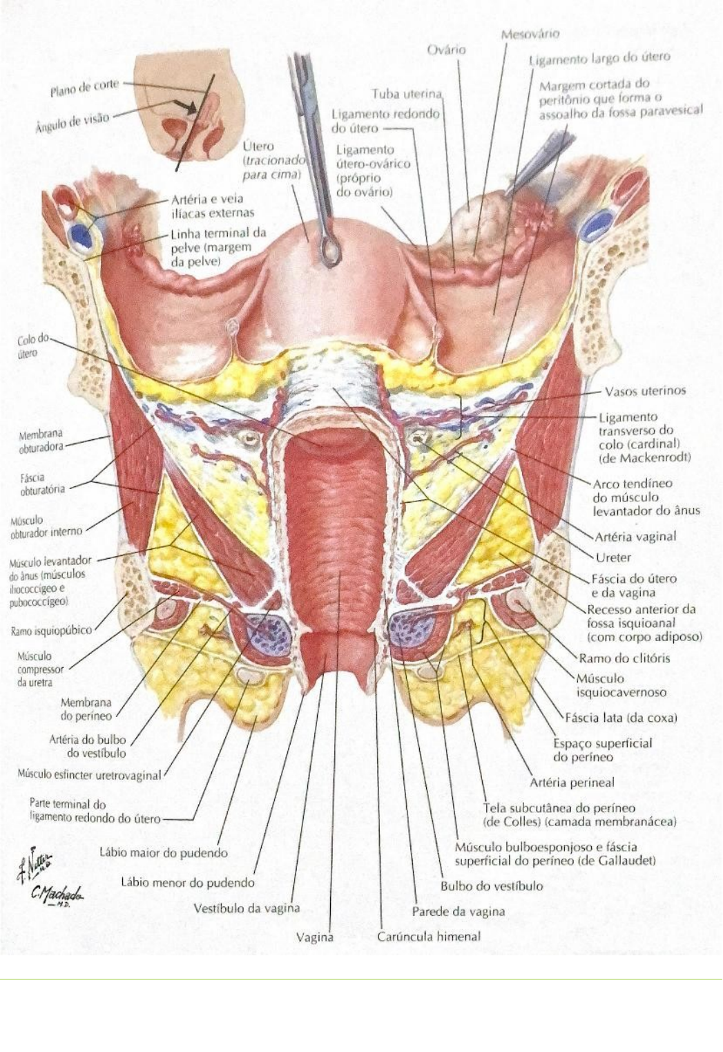 Anatomia Do Utero Ressonancia Magnetica Neoplasia De Colo Uterino.