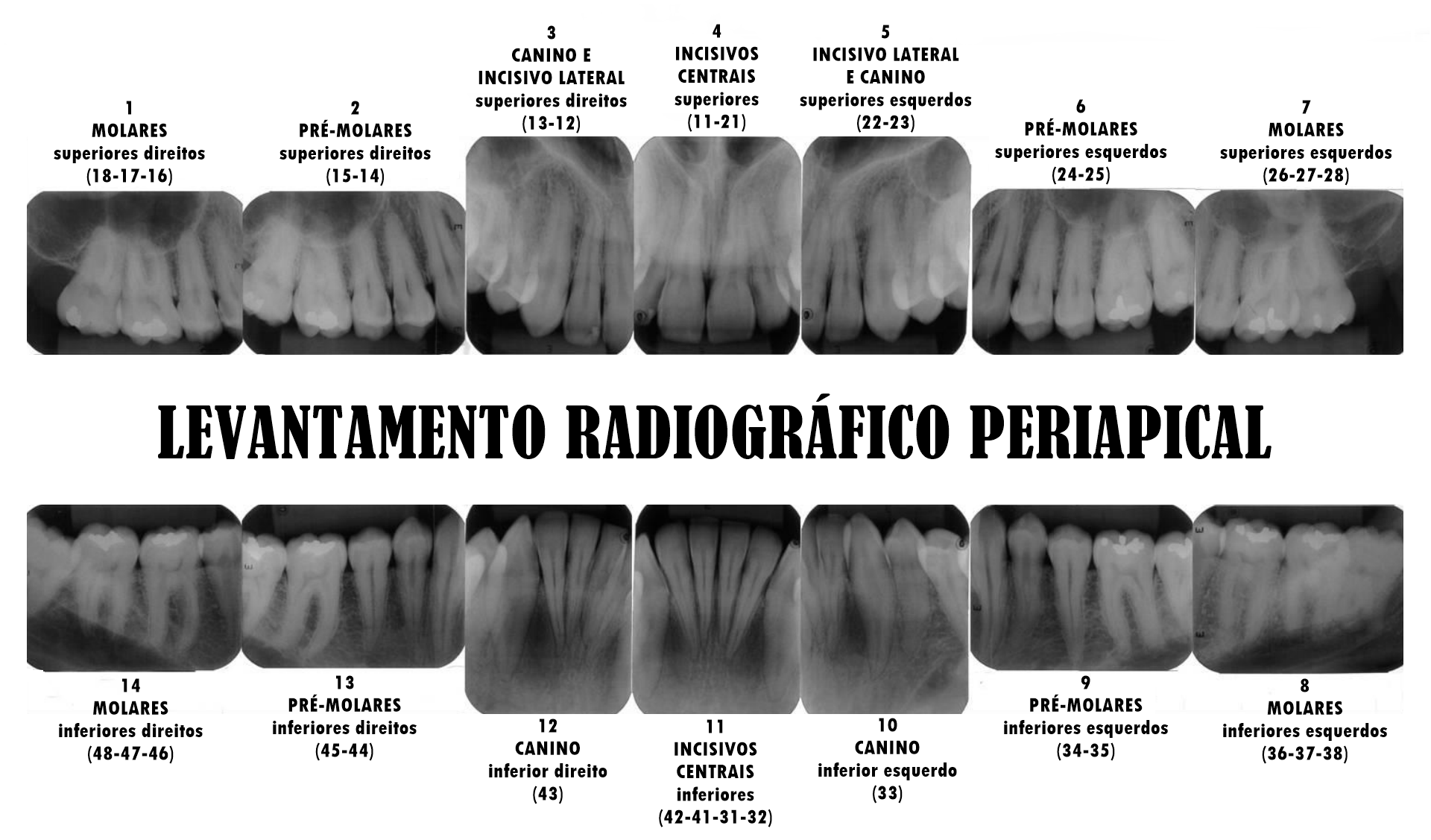 Levantamento Periapical Radiologia Odontol Gica