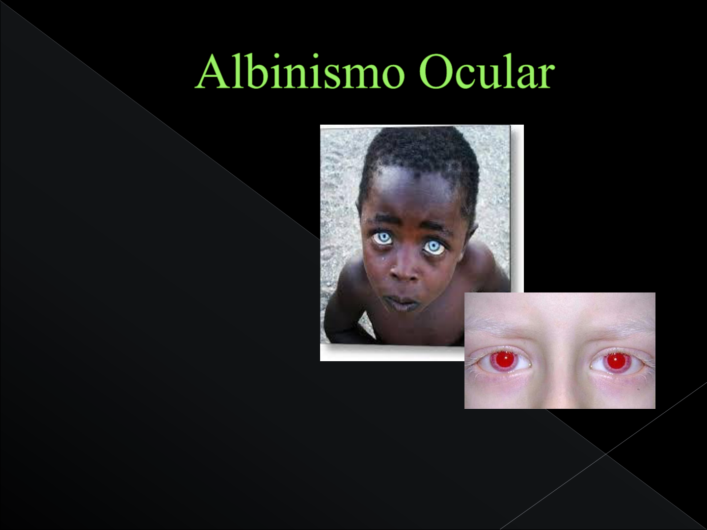 Grátis: albinismo - Material Claro e Objetivo em PDF para Estudo Rápido, image size:1440x1080