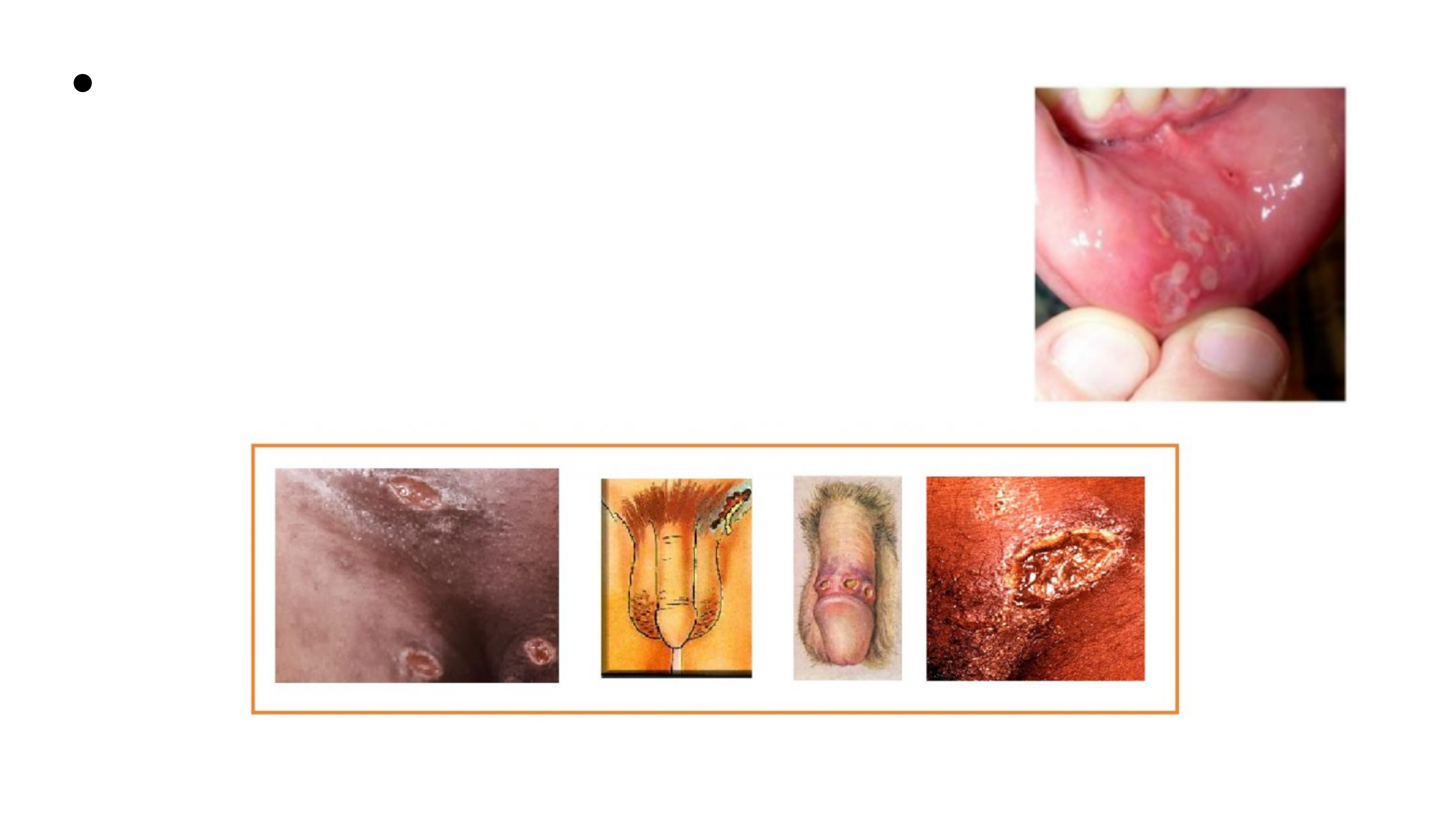 Grátis: slide sobre as principais IST's - Material Claro e Objetivo em PDF  para Estudo Rápido, image size:2880x1620