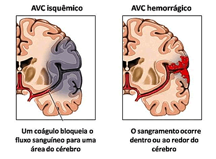 Imagem relacionada