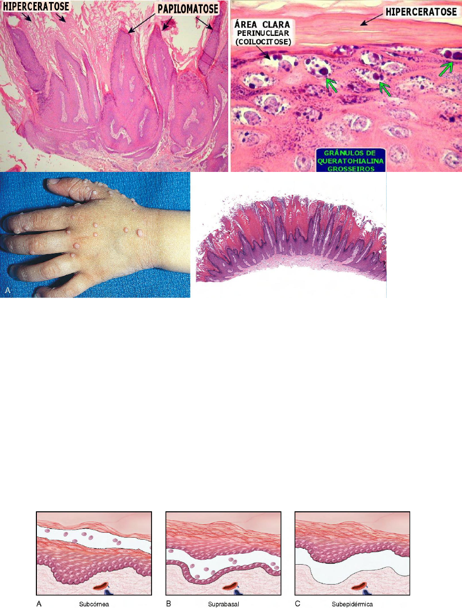 Grátis: TUMORES DA PELE - Material Claro e Objetivo em PDF para Estudo  Rápido, image size:927x1220