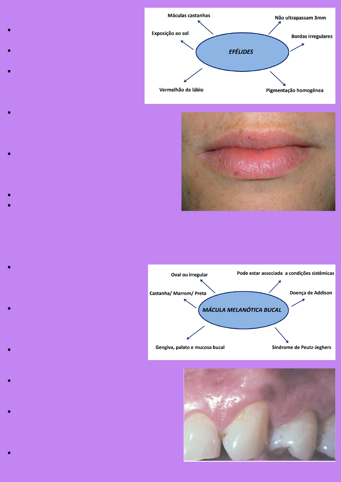 fda melanotan Mácula melanótica labial: diagnóstico, diferenciais e condutas clínicas main image 0