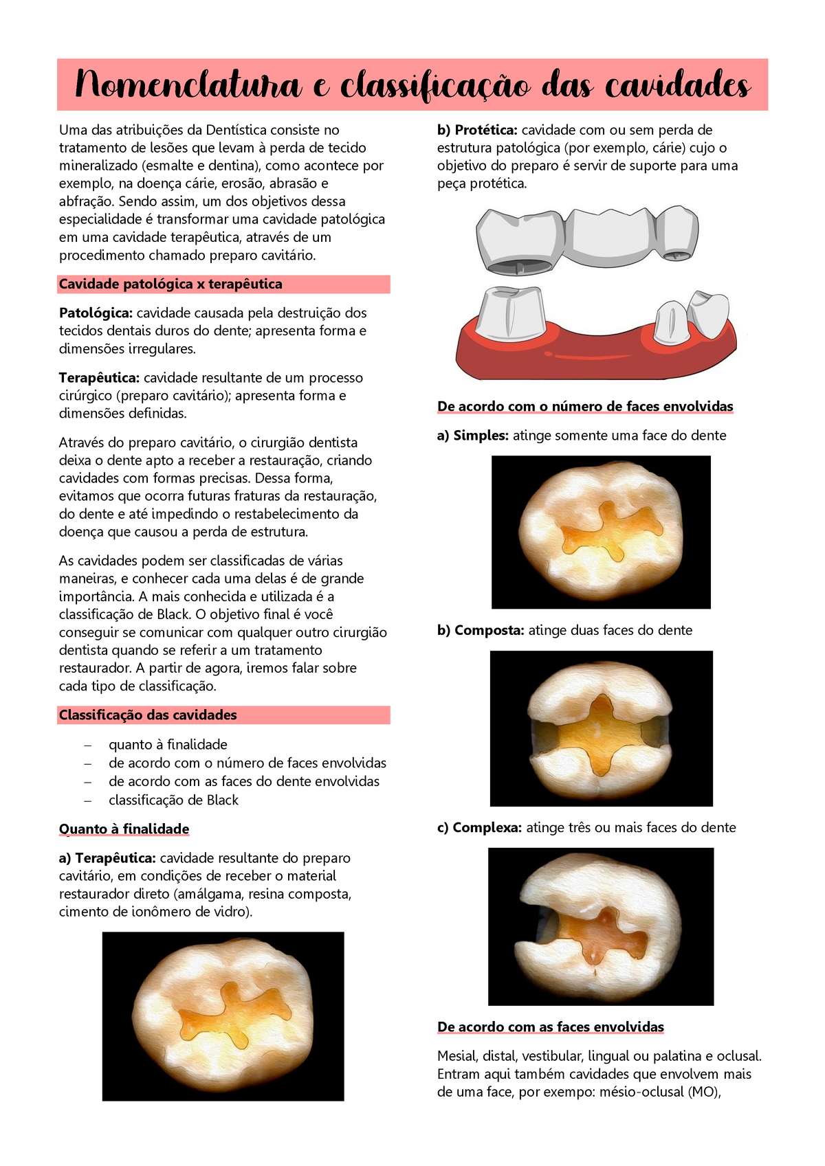 Nomenclatura E Classifica O Das Cavidades Dent Stica