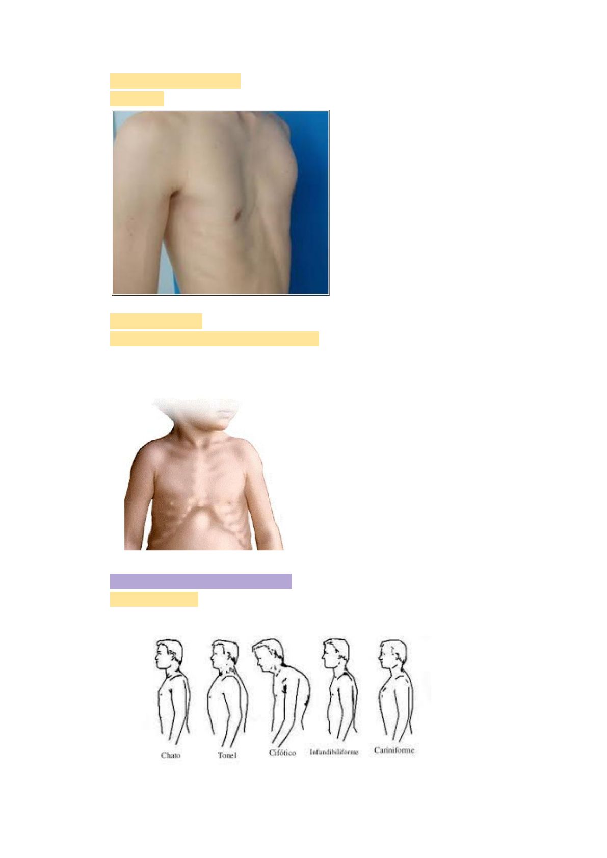 Semiologia da dispneia - Semiologia Médica