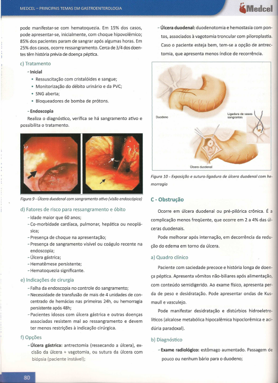 vagotomía y piloroplastia