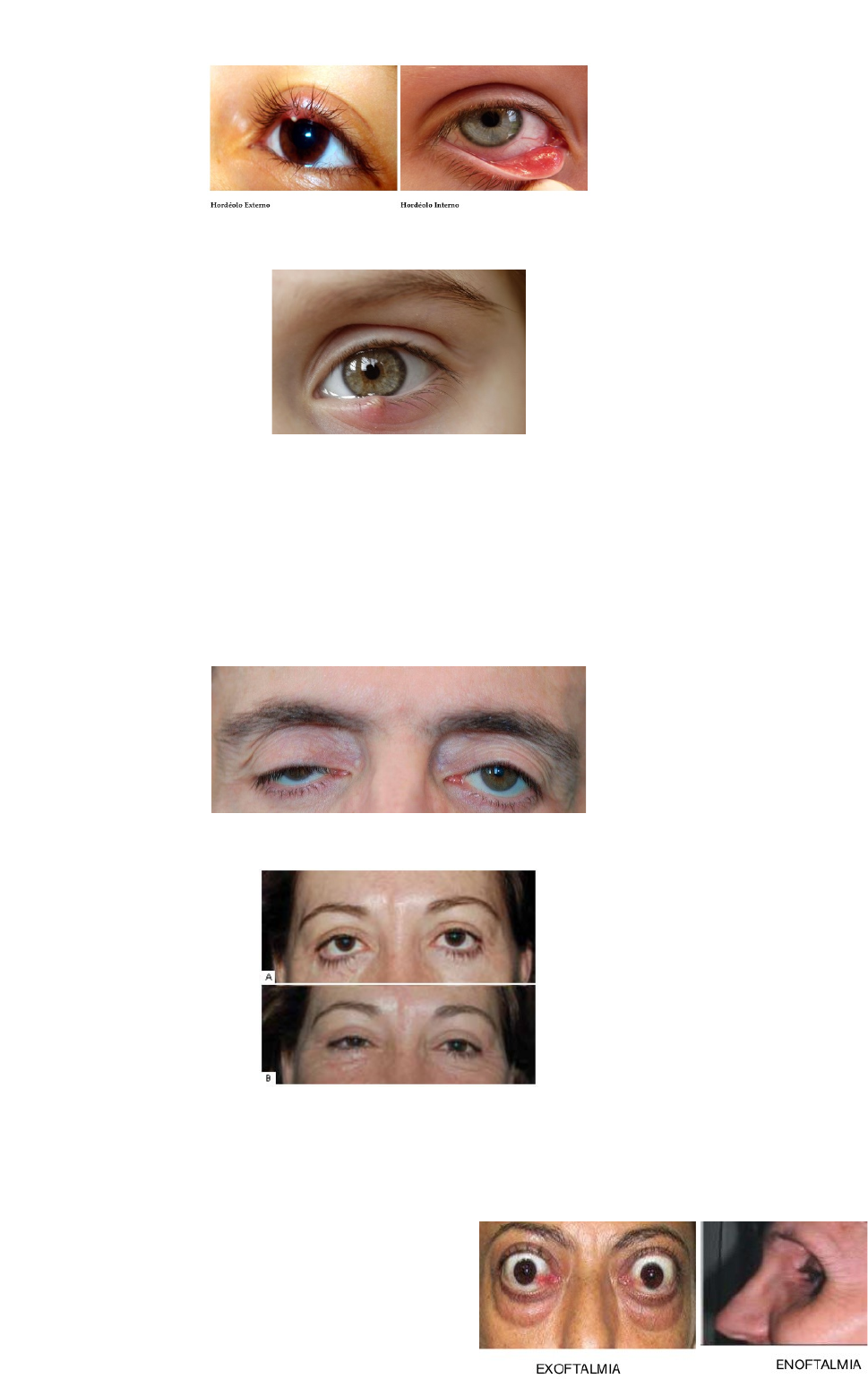 Doenças Sistêmicas e Oftalmologia | PDF | Epidemiologia | Medicina Clínica, image size:969x1540