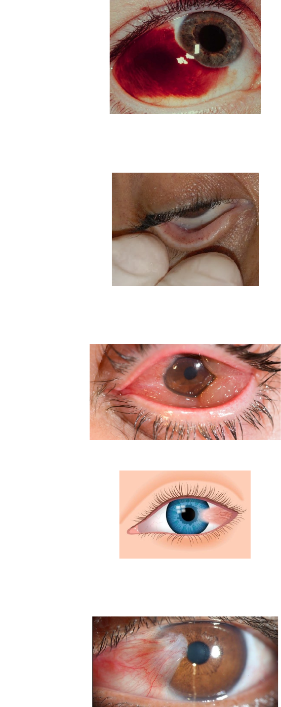 Diccionario integrado optometría \u0026 oftalmología by Joaquín Guerrero Vargas  - Issuu, image size:569x1429