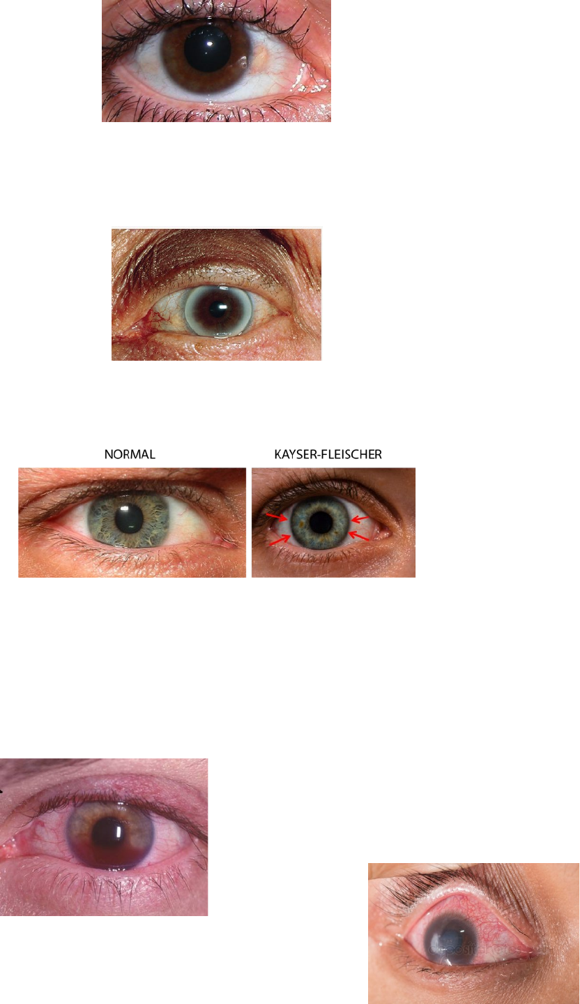 Grátis: Resumo de Oftalmologia e Otorrinolaringologia - Material Claro e  Objetivo em PDF para Estudo Rápido, image size:832x1439