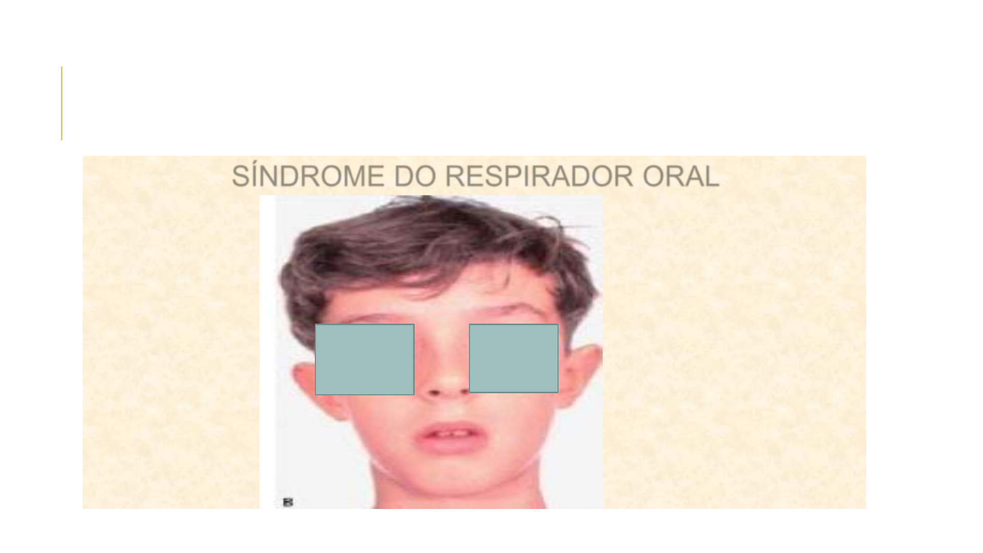 Cuándo operar a un niño de vegetaciones, image size:1920x1080