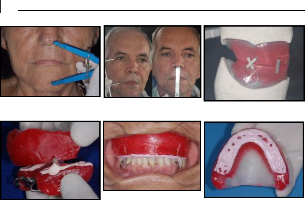 Relações maxila e mandíbula em dentados 