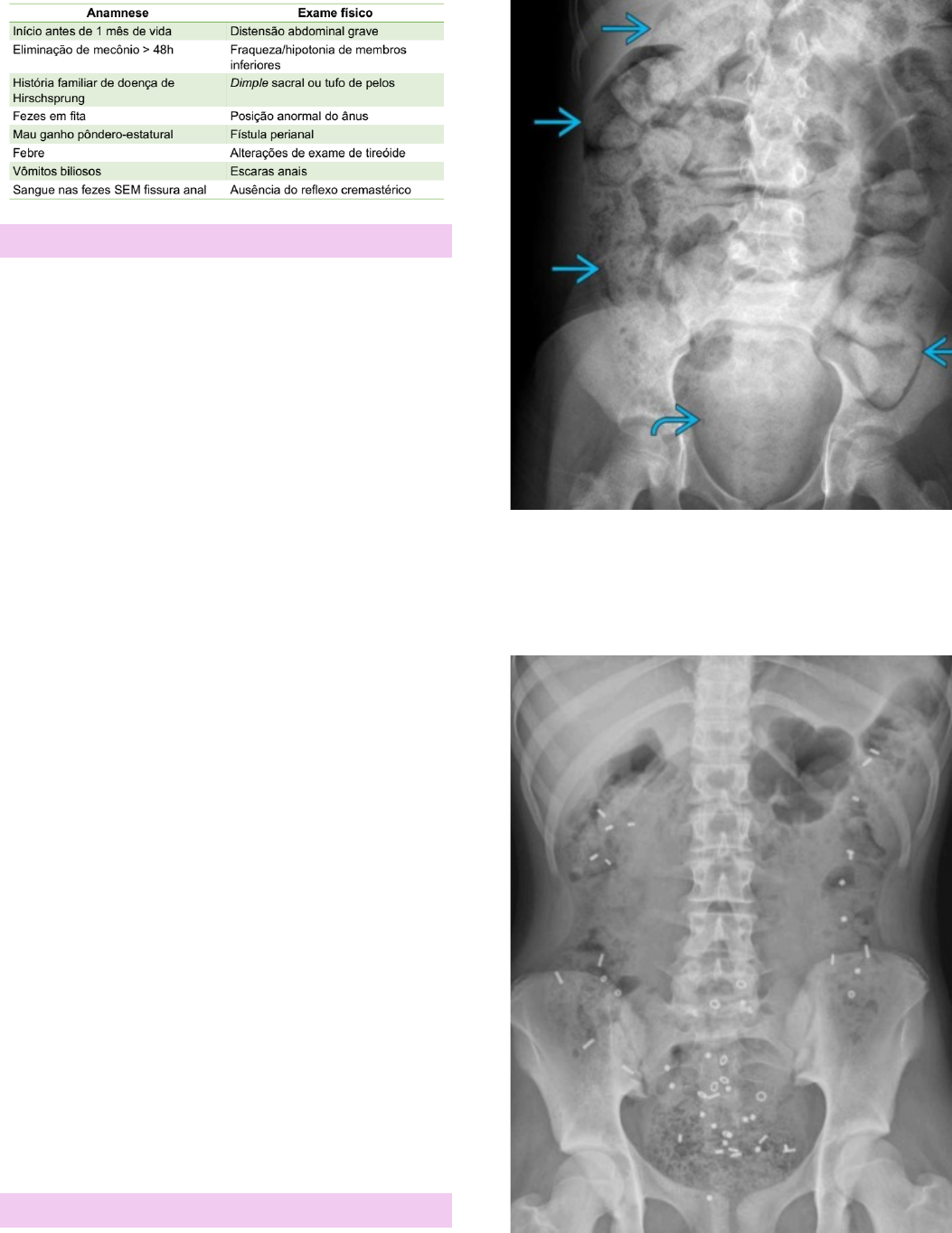Grátis: Constipação Intestinal - Material Claro e Objetivo em PDF para  Estudo Rápido, image size:1053x1364