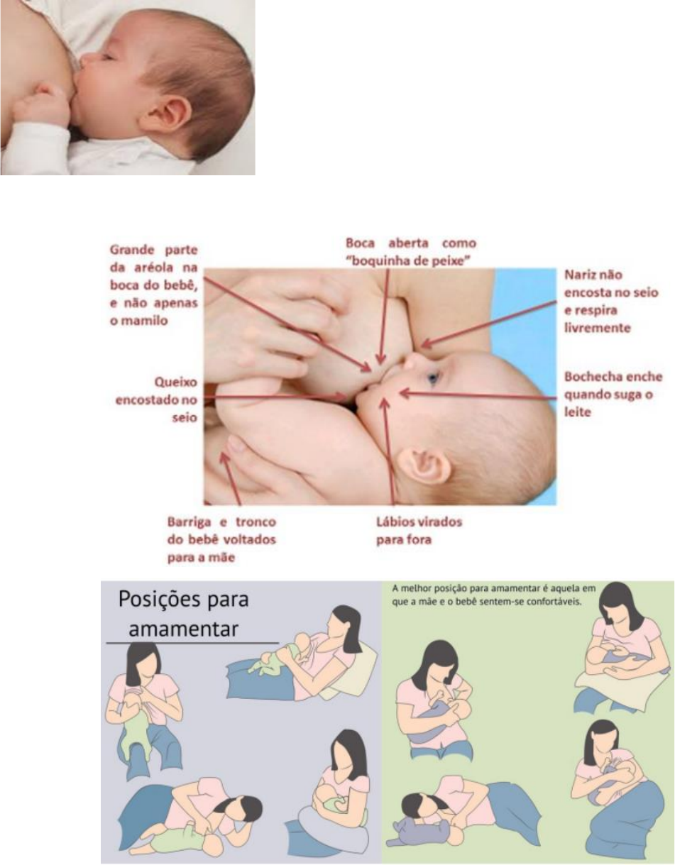 Amamentação e alojamento - Pediatria I