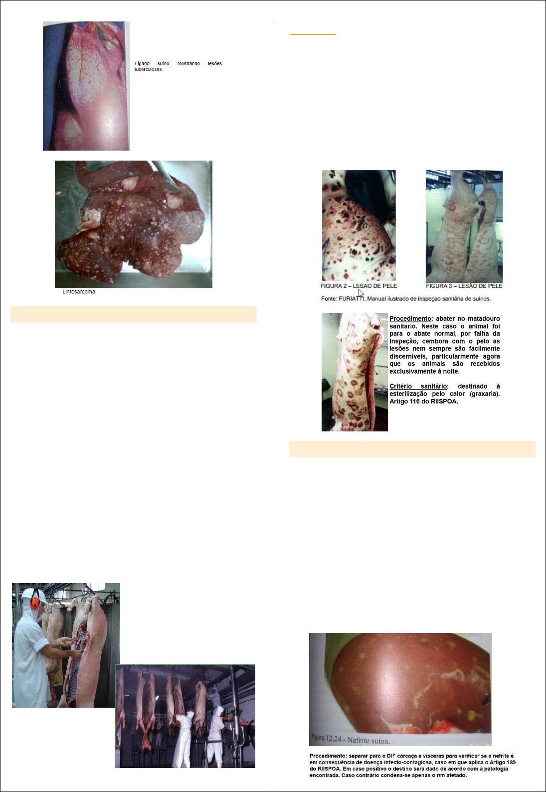 Capítulo 11: Errnvphglfrvruj | PDF | Sistema urinario | Cirugía, image size:1095x1588