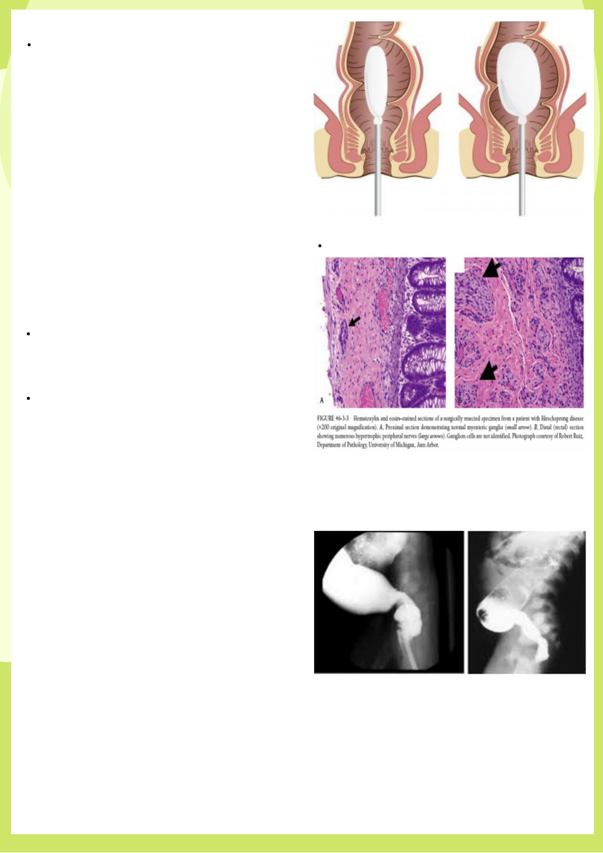 Grátis: Constipação na infância - Material Claro e Objetivo em PDF para  Estudo Rápido, image size:1190x1684