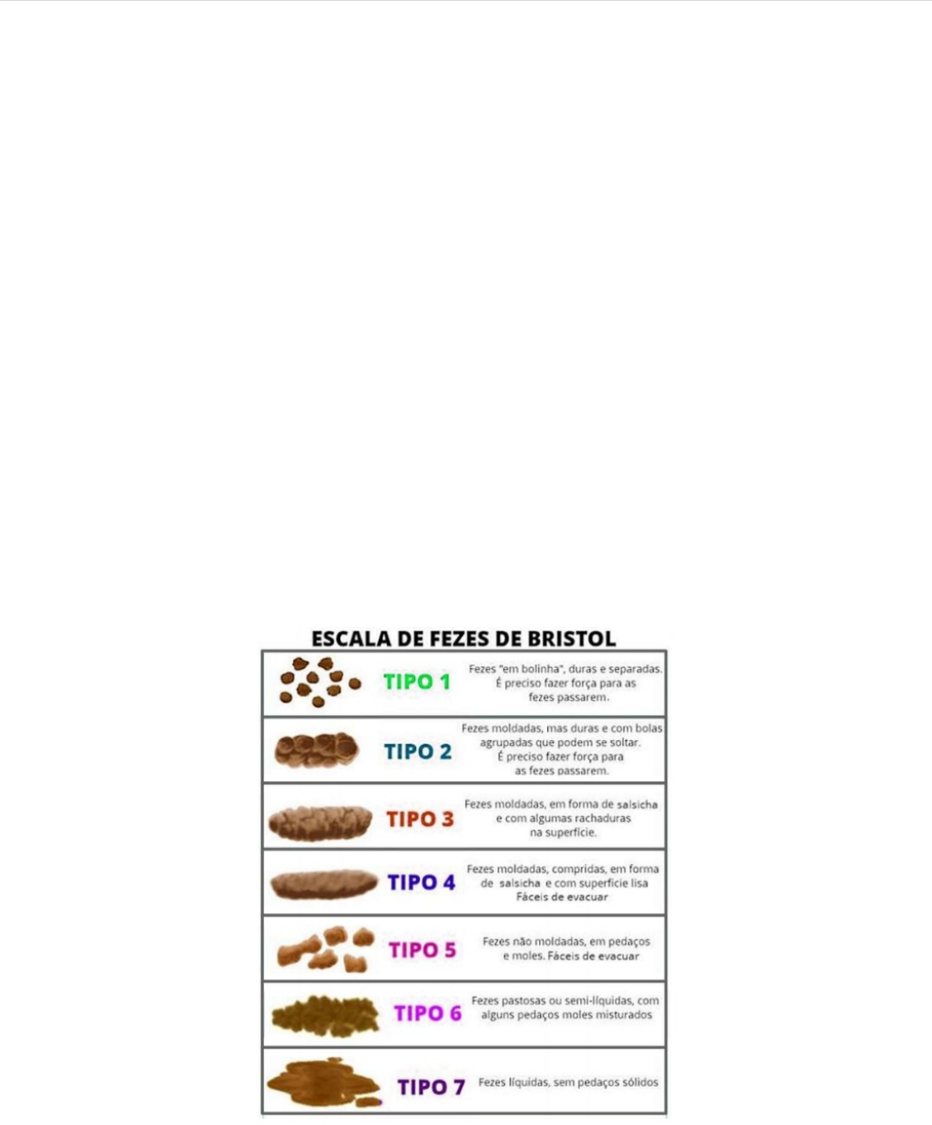 Dr. Mateus Andrade - Gastro - Pediatra - DOENÇA DE HIRSCHSPRUNG A doença de  Hirschsprung é uma doença congênita rara que afeta a motilidade intestinal.  O intestino grosso depende de uma rede, image size:1046x1263