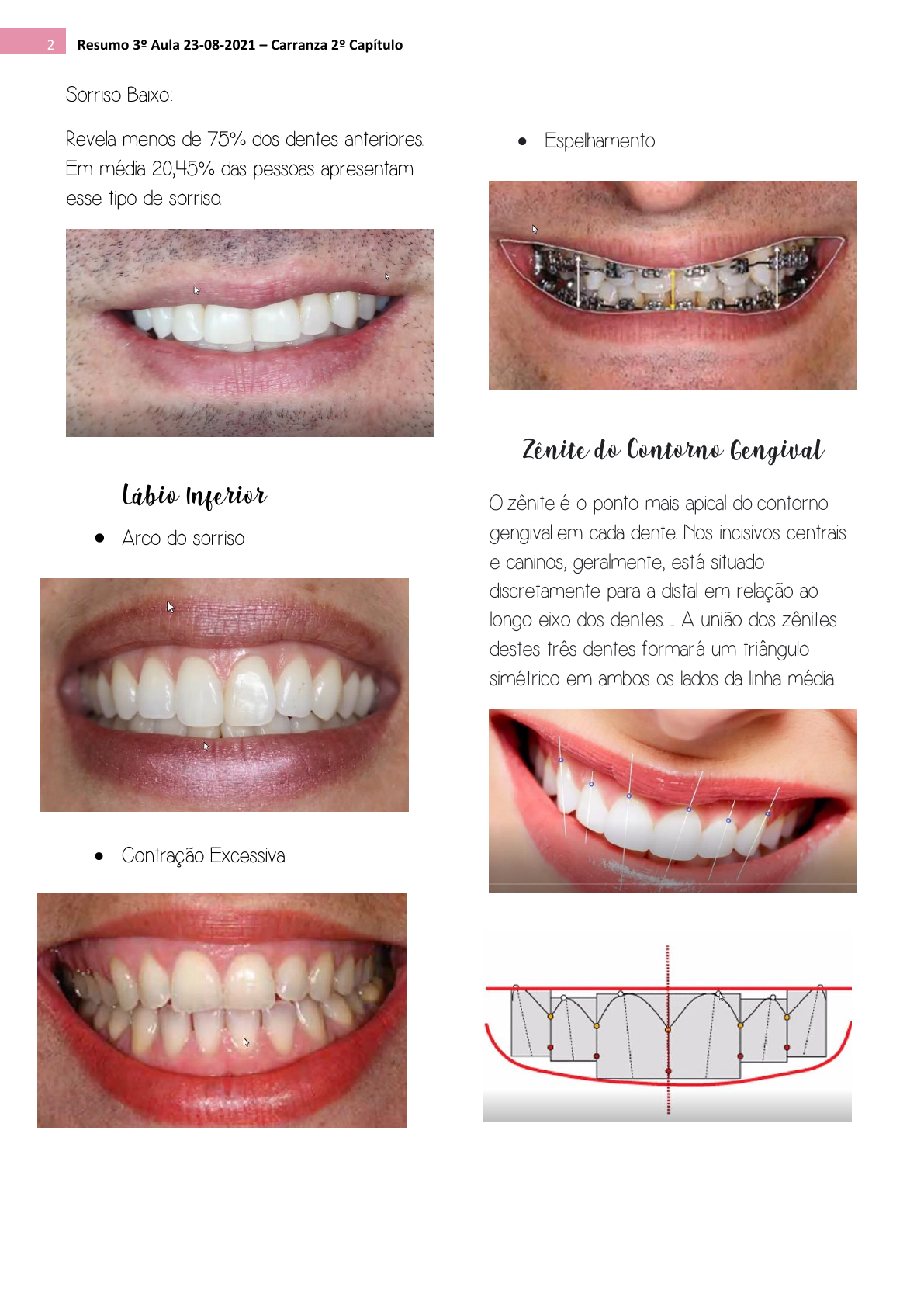 Resumo Periodontia - Periodontia