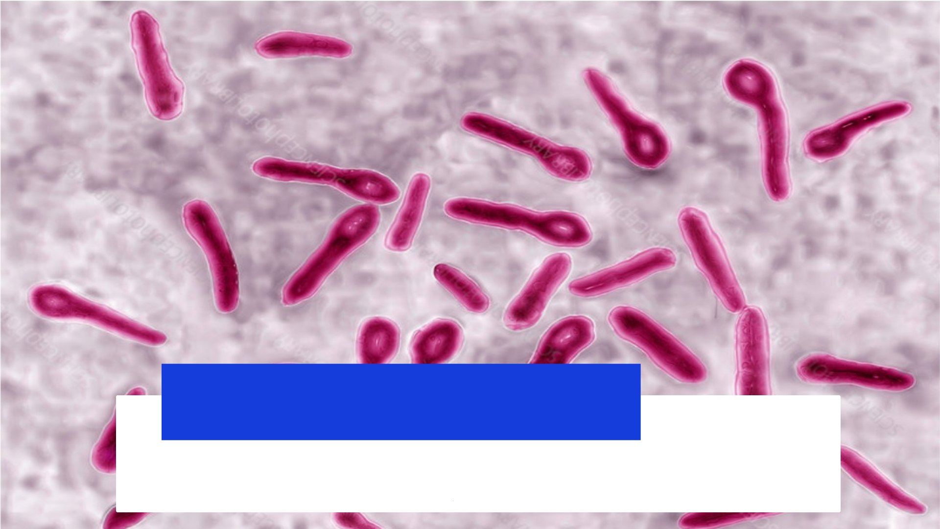 Grátis: TÉTANO - MICROBIOLOGIA - Material Claro e Objetivo em PDF para  Estudo Rápido, image size:1920x1080