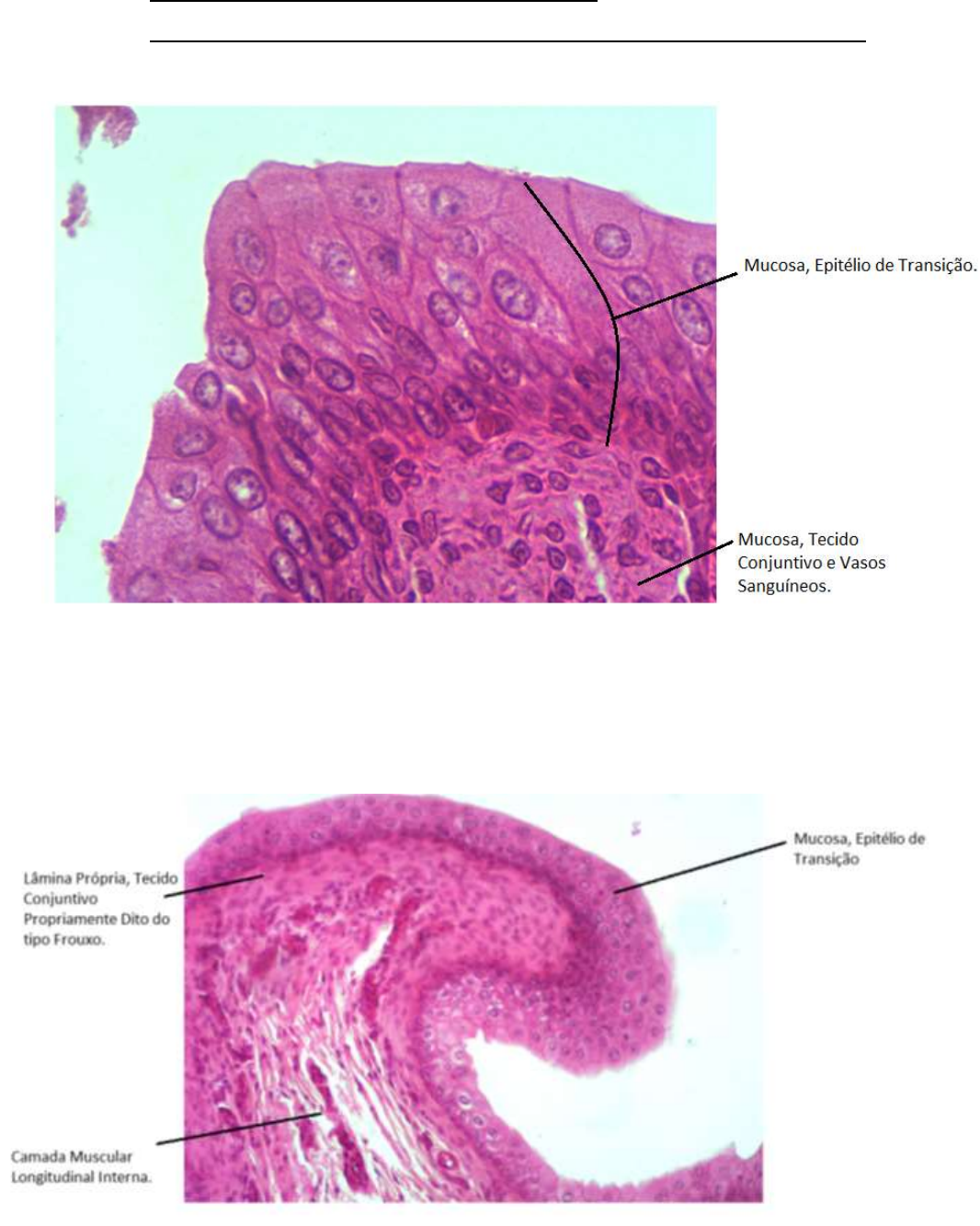 HISTOLOGIA SISTEMA URINÁRIO RIM URETRA E BEXIGA Histologia Geral